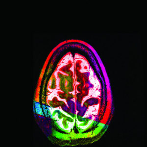 good-egg-axial-mri-view-of-the-artists-brain